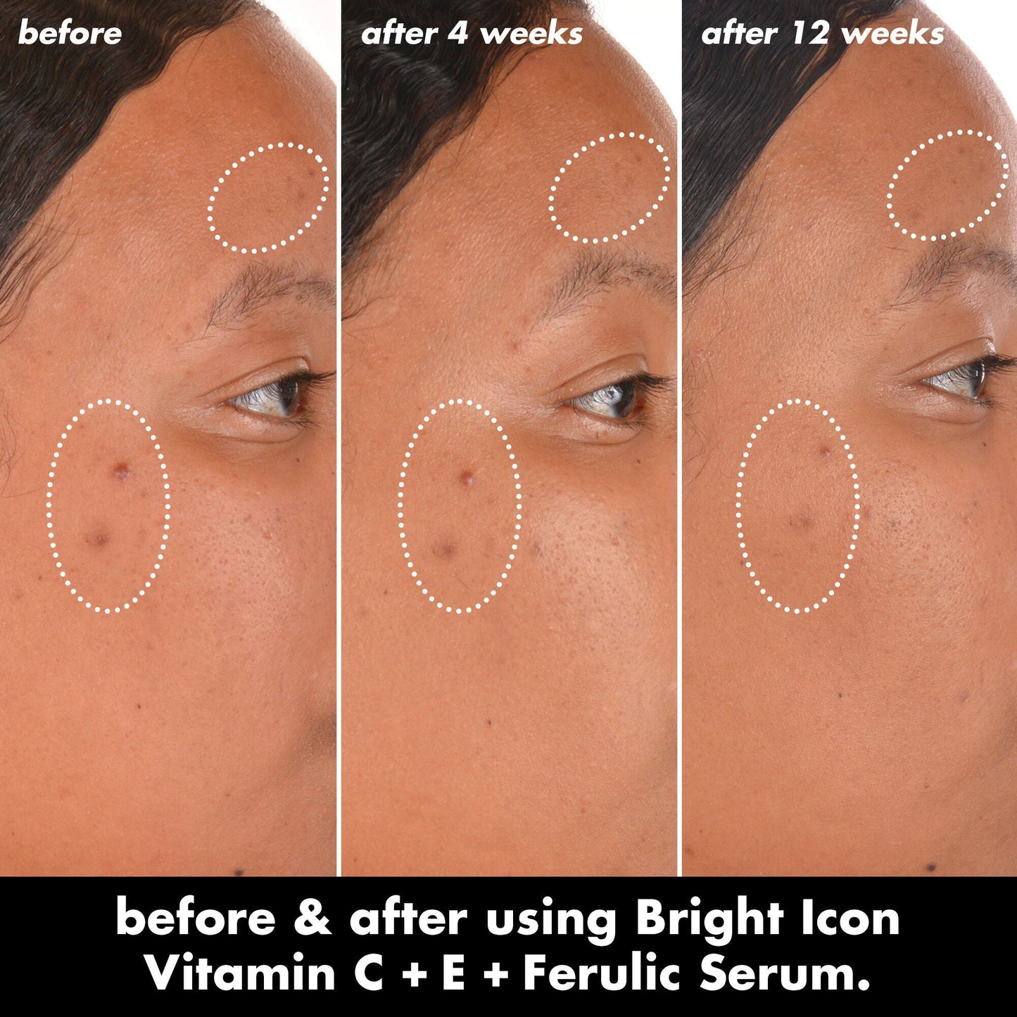 bright-icon-vitamin-c-e-ferulic-serum-b6 0226_EDU_BrightIconVitC_BA_Chanel_TRIPTYCH_c58f2fc8-209d-414f-9ba3-666a07a94887.jpg