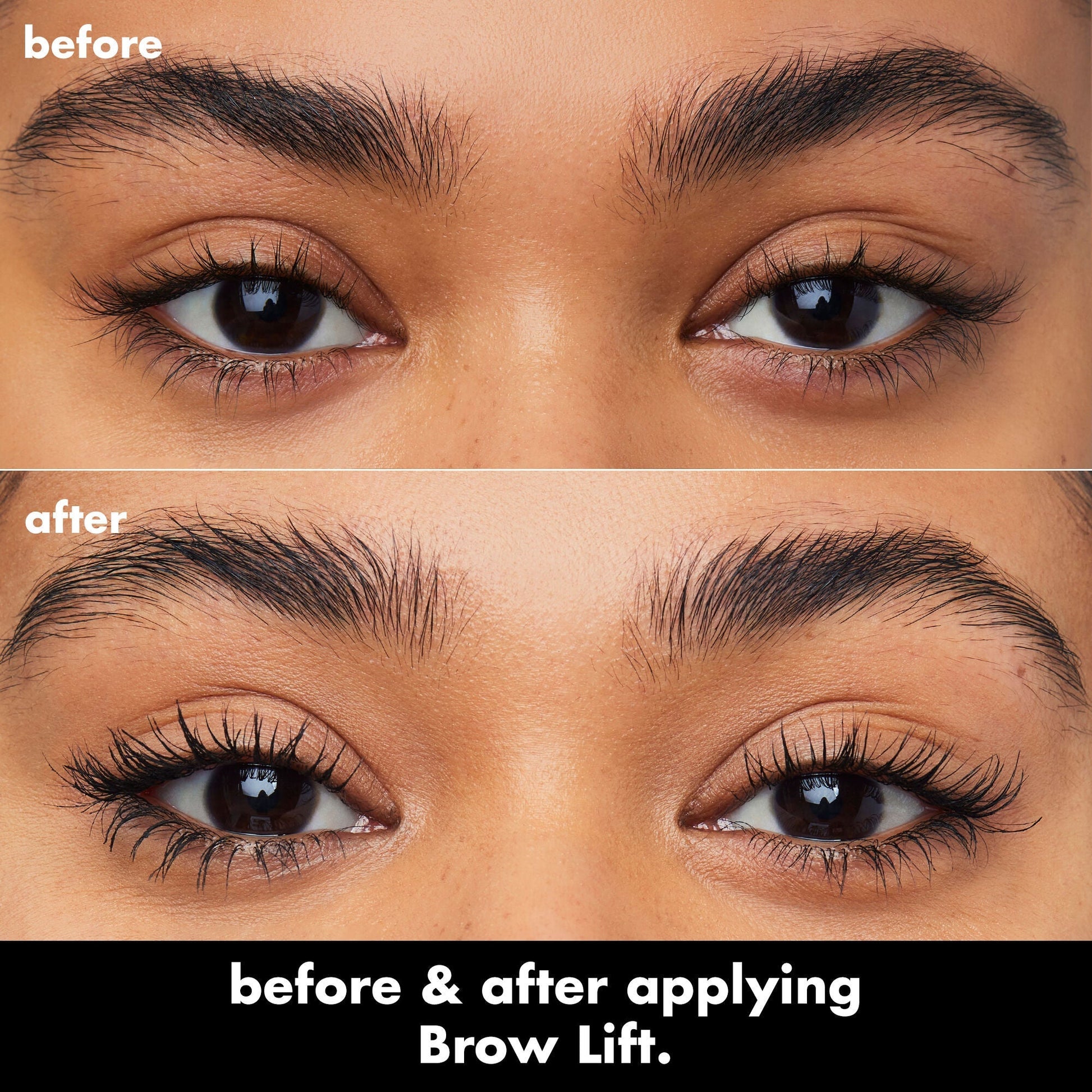 brow-lift-g3 0326_EDU_BrowLift_BA.jpg