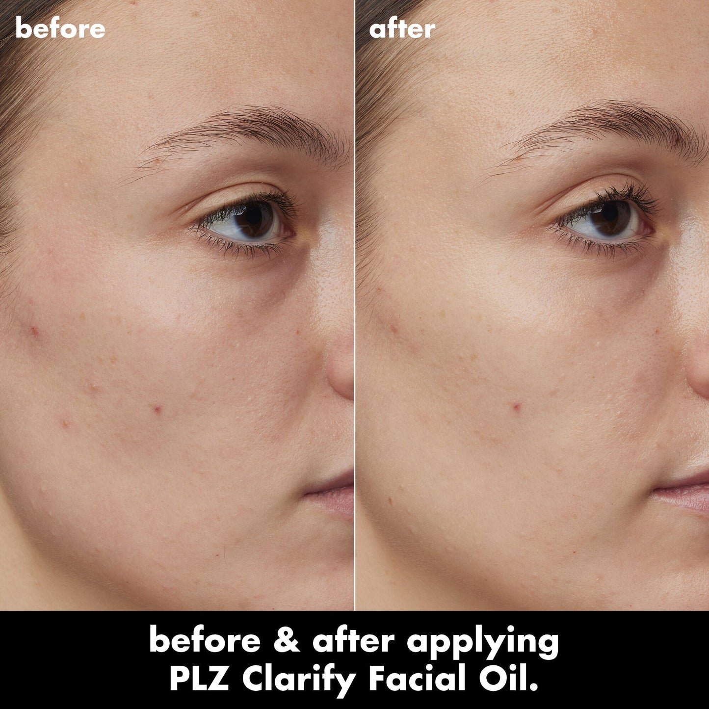 plz-clarify-facial-oil-w3 0326_EDU_PlzClarify_BA_Kelly.jpg