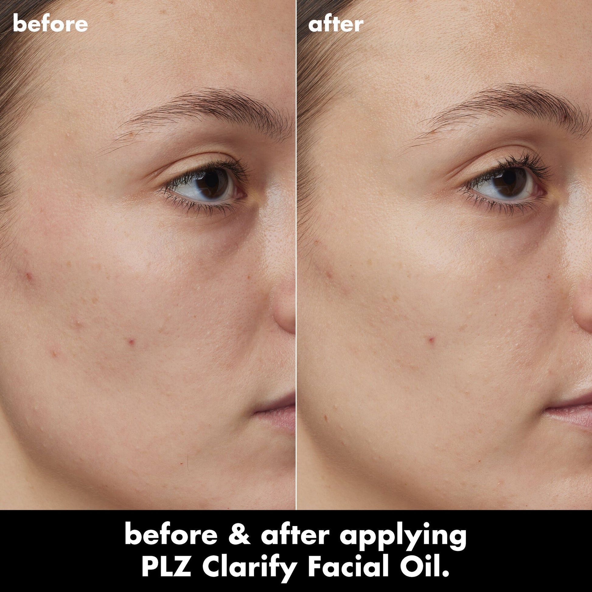 plz-clarify-facial-oil-w3 0326_EDU_PlzClarify_BA_Kelly.jpg