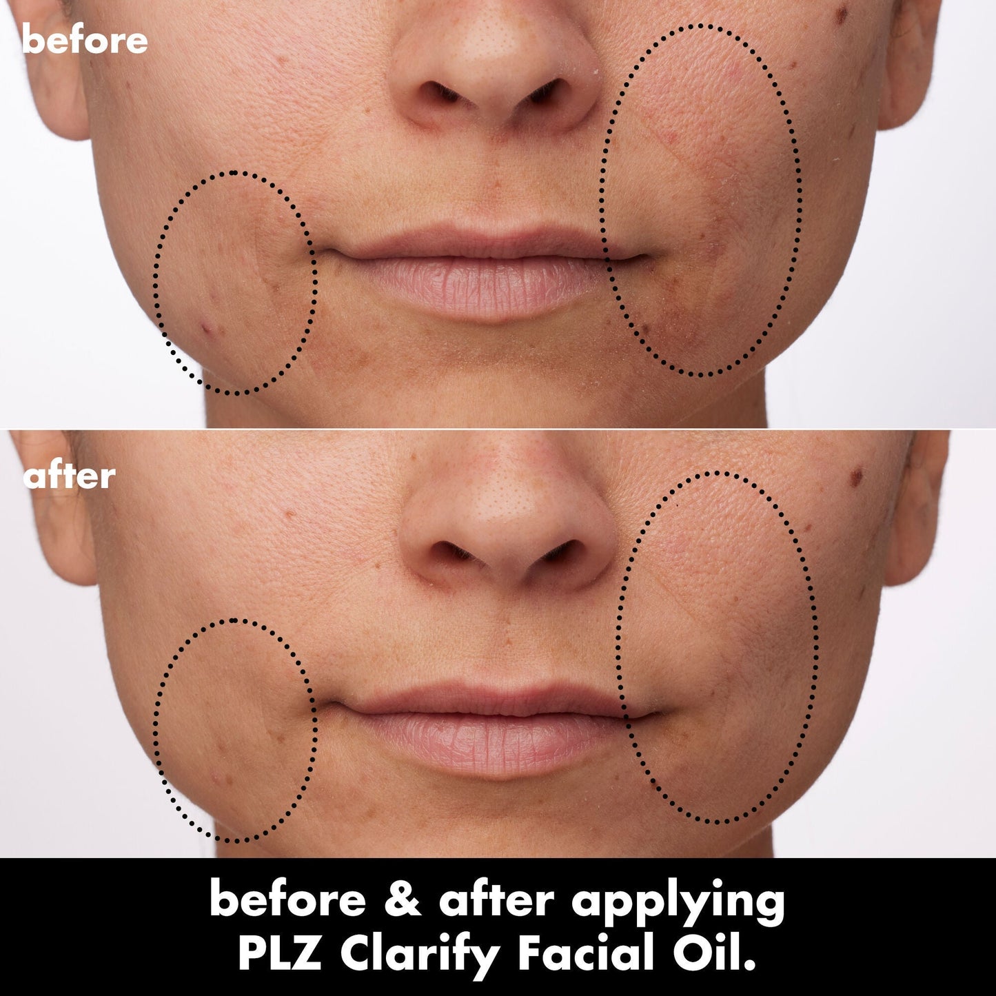 plz-clarify-facial-oil-w3 0326_EDU_PlzClarify_BA_Paula.jpg