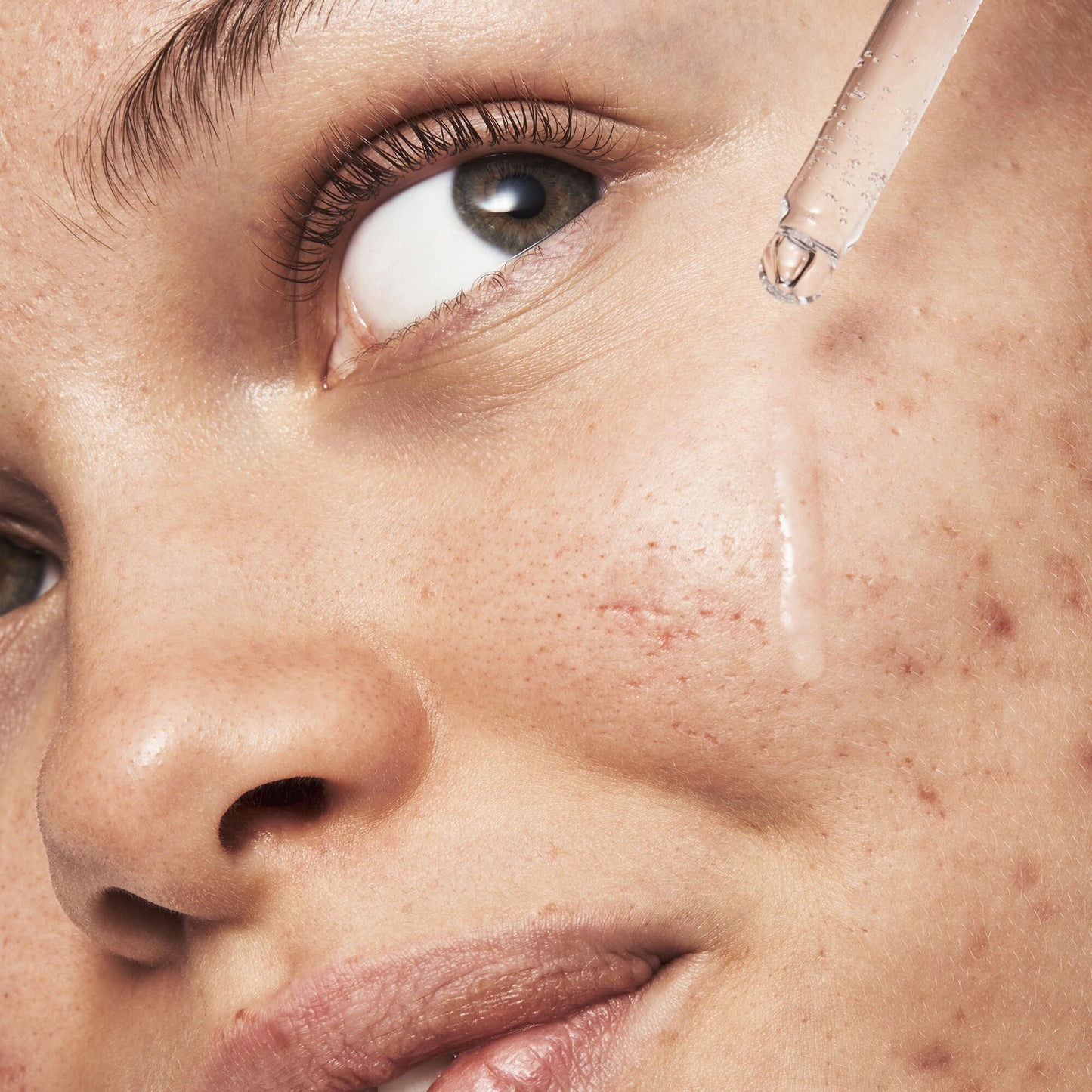 blemish-breakthrough-triple-acid-resurfacing-serum-o9 121321_Marley-Acne-Regimen_0254_FINAL_IGF.jpg