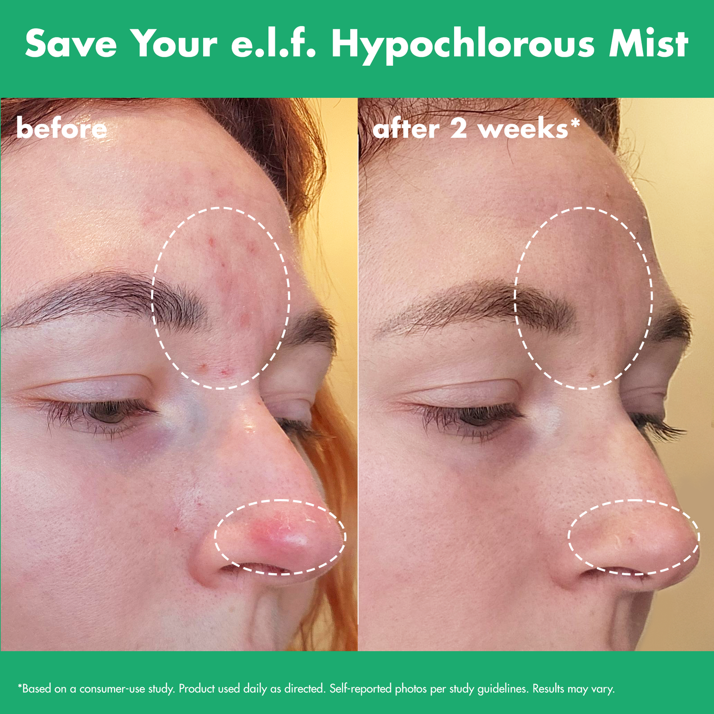 save-your-e-l-f-hypochlorous-mist-w7 FA26_EDUCATION_SAVEYOURELF_USAGE_BA1_WITHOUT_CLAIMS.png