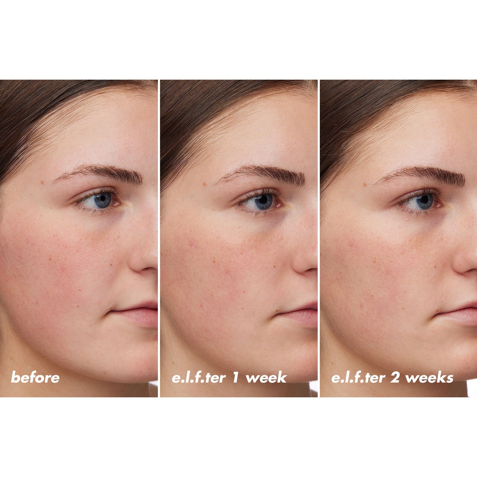 holy-hydration-barrier-goals-cream-regular-i4 XX26_EDUCATION_HH-BarrierGoals_B_A_Zoe_TRYPTICH_74c905bd-67bd-4b91-b633-2b01a8905cb8.jpg